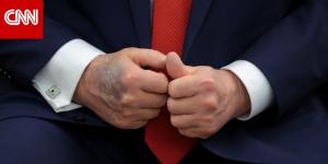 ترامب لـ"وول ستريت جورنال" عن كدمات يده: أريد "دماً لطيفاً ورقيقاً يتدفق عبر قلبي"