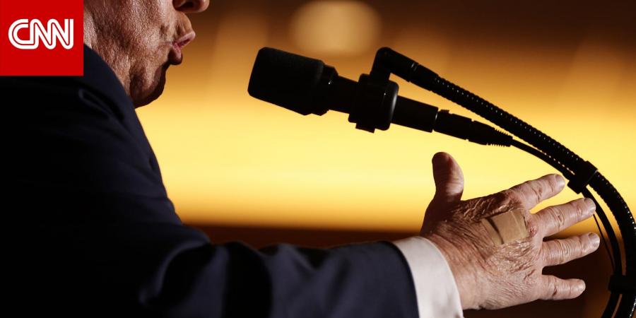 ما تفسير البيت الأبيض لوضع ترامب ضمادة على يده؟