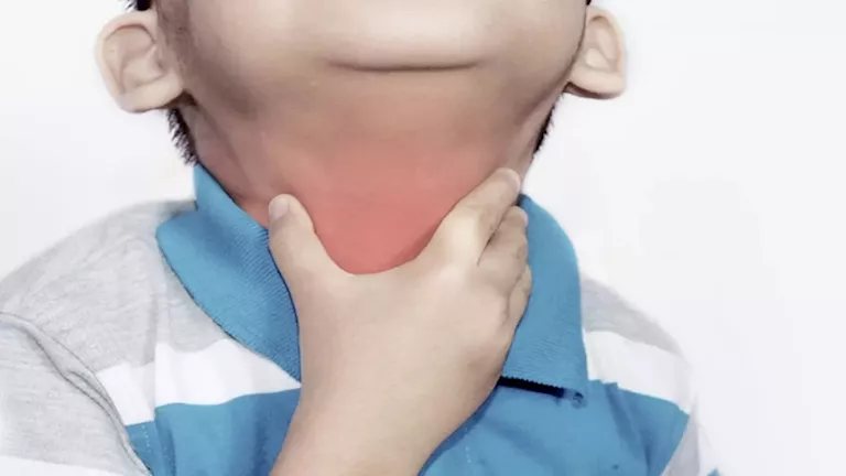 ما هو الاختناق الحنجري؟.. أستاذ أمراض الصدر يوضح علامات الإصابة